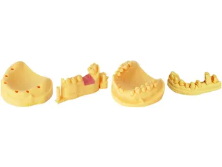 Shining3D Dental Model Resin DM12 1Kg Geel - 2