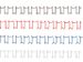 Draadrug GBC 11mm 34-rings A4 zwart 100stuks - 1