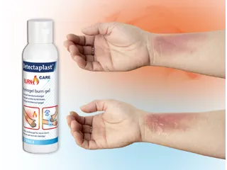 Burn Care Gel Voor Brandwonden Flacon van 118ml - 6