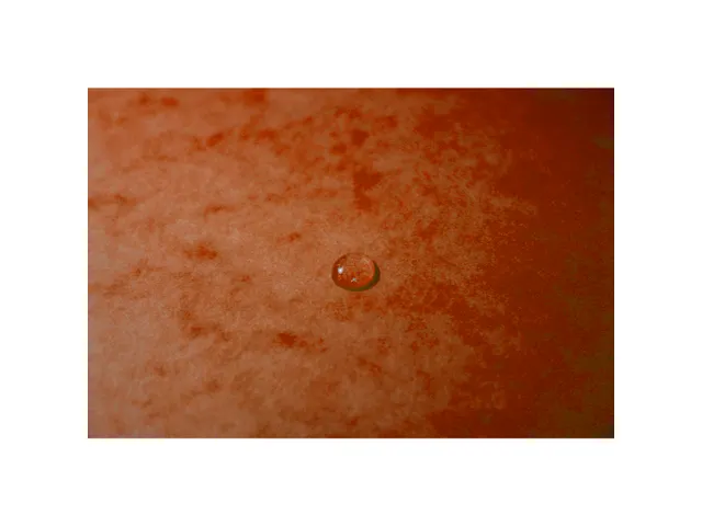 Elastomap glansk.425 3klep Max Cap oranj