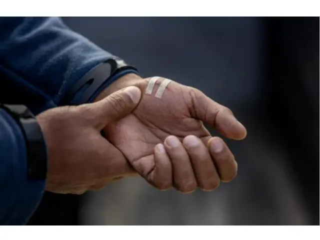 Steri-Strip Wondsluitingen