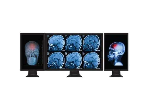 Mini Displayport Naar Displayport Multi-monitor Splitter 3-Poorts Hub