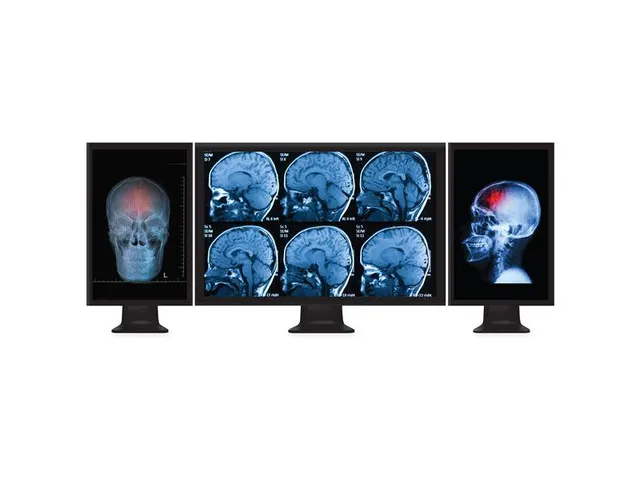 Mini Displayport Naar Displayport Multi-monitor Splitter 3-Poorts Hub